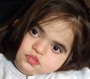 mentally disabled child