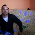 شاهد بالفيديو رجل يعيش بنصف رأس فقط بسبب... " سبحان الله "