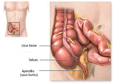 Gambar Sakit Jantung