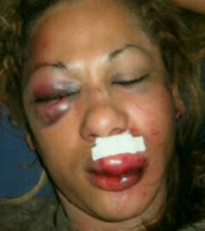 1woman+badly+beaten+by+husband+lindaikejiblog.jpg
