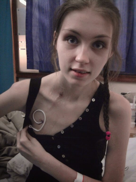 EhlersDanlos Syndrome Are You Aware? Lucy Watts MBE / Lucy Watts Ltd