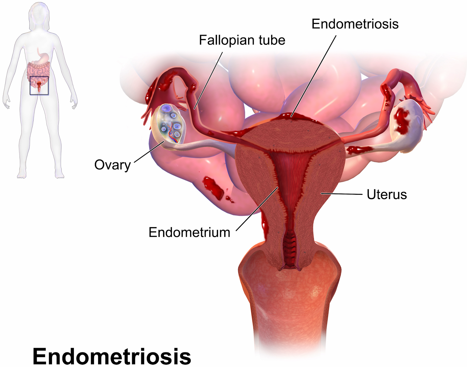 Health, Safety and the Environment (HSE) Female Infertility Explained