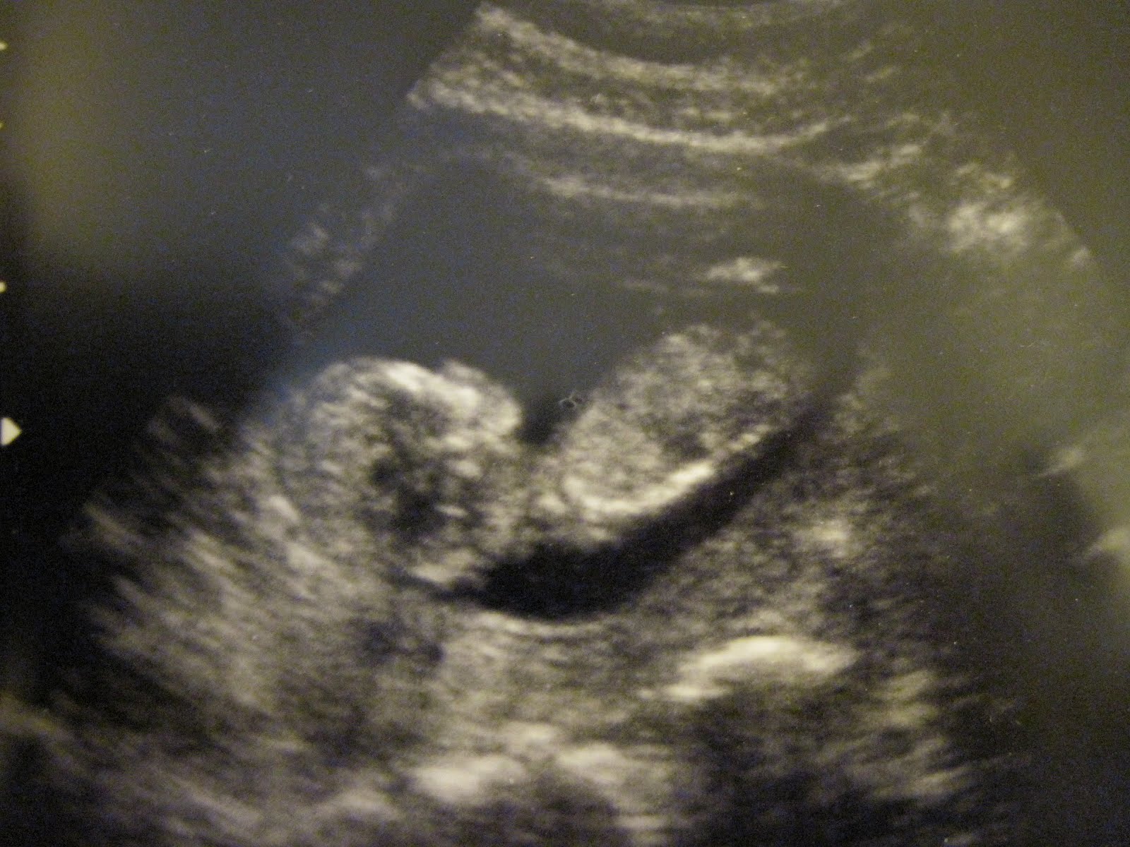 Today's Gift ultrasound pic