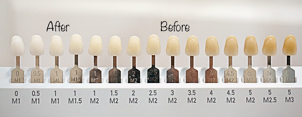 High definition wallpapers printable enamel colour chart 26cellular2.gq picture regarding Tooth Shade Chart Printable known as High definition wallpapers printable teeth coloration chart 26cellular2.gq