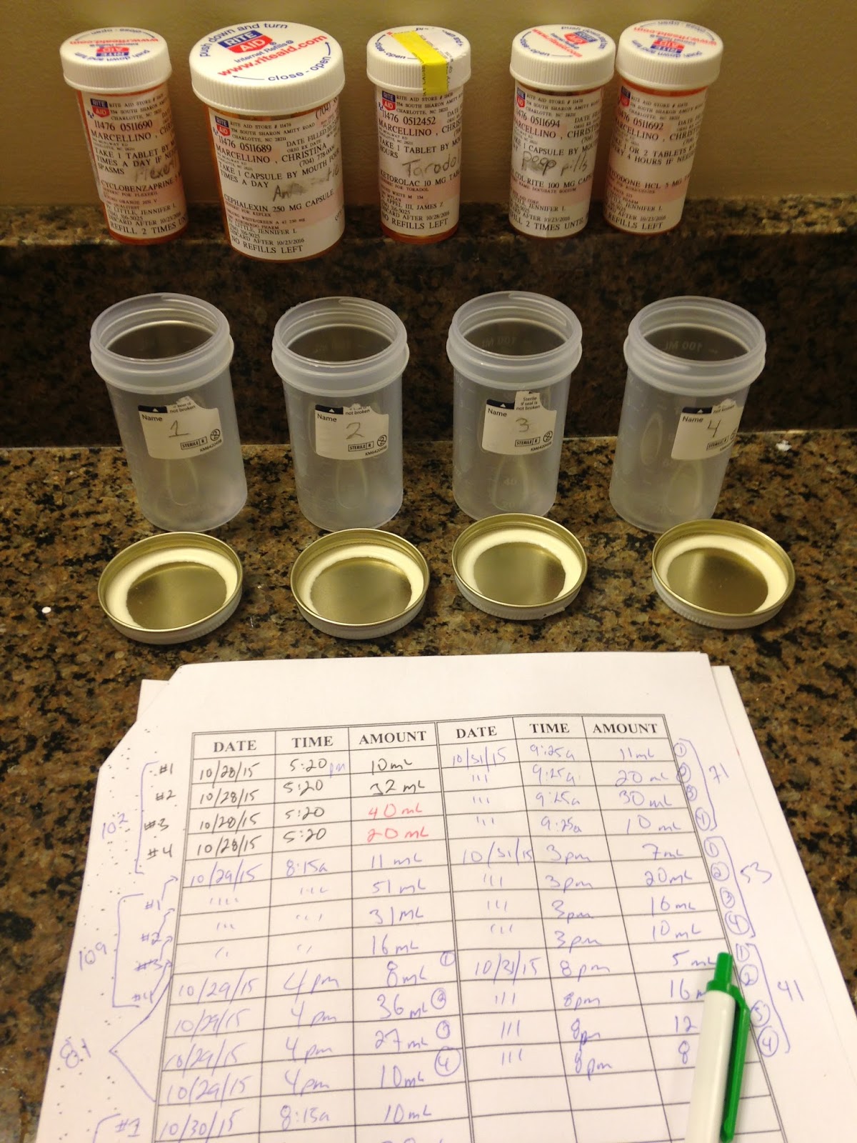 Mastectomy 101 Surgical Drains & Tissue Expanders (10 Weeks Post Op