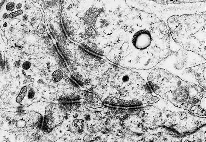 El blog de Antonio José Miralles Orgánulos celulares