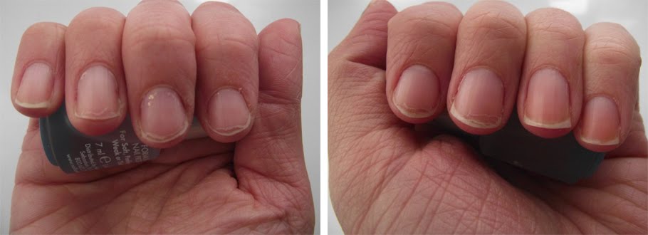 Beauty in the mirror: nailtiques formula 2 *week 1* Beauty In The Mirror: Nailtiques Formula 2 <em>Week 1</em>