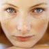 Clear Skin Blemishes With Natural Treatments