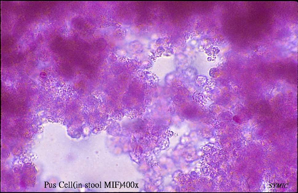 KGrowth What can we know about pus cell?