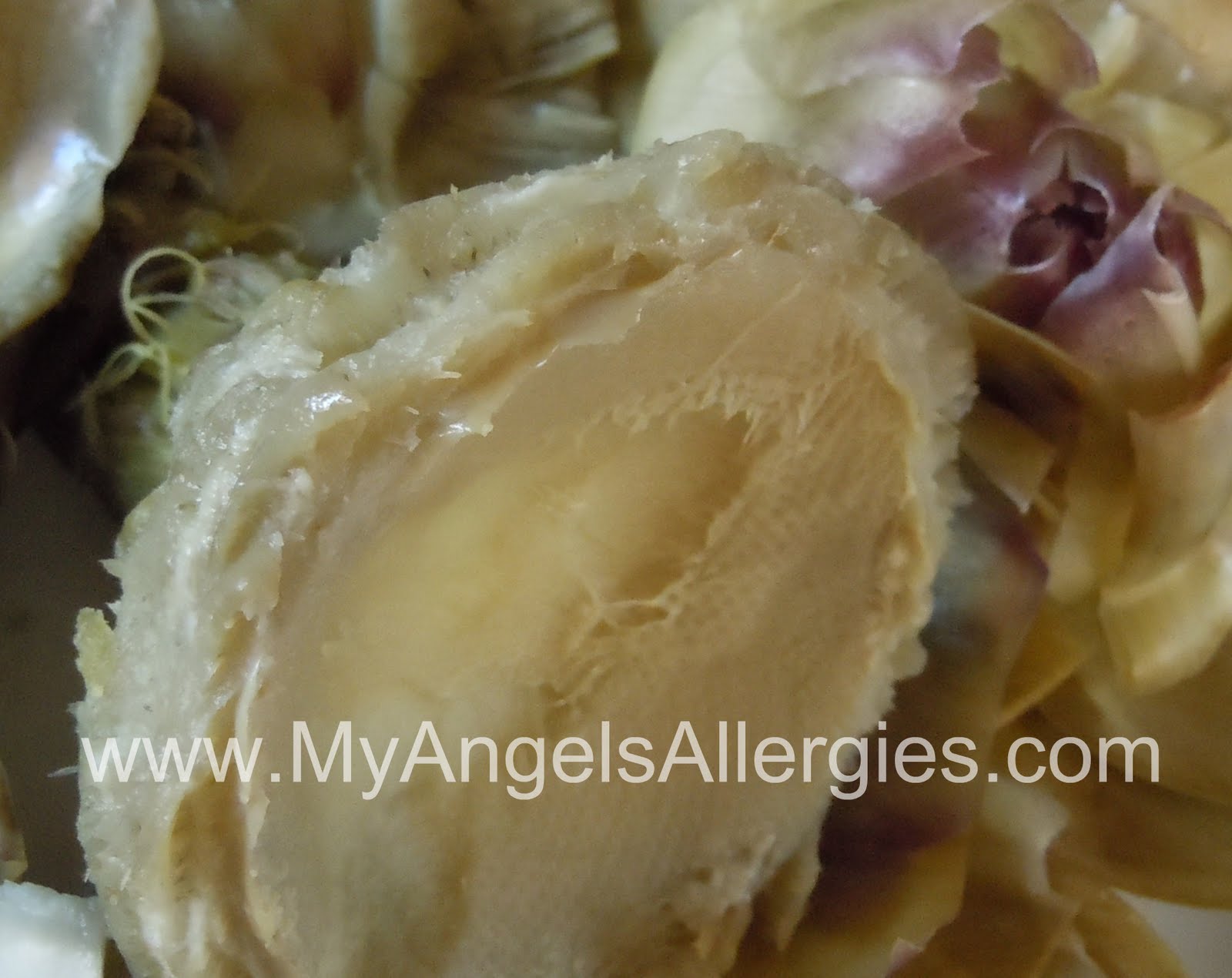 Artichokes The Heart My Angel's Allergies