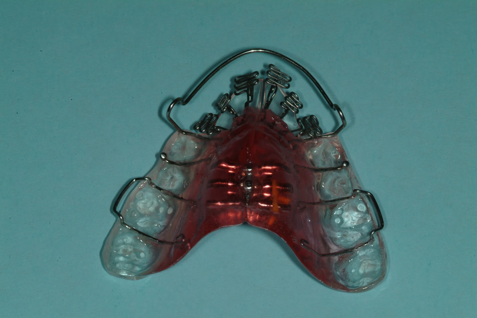 Retain This! DNA Appliance Day 1 14