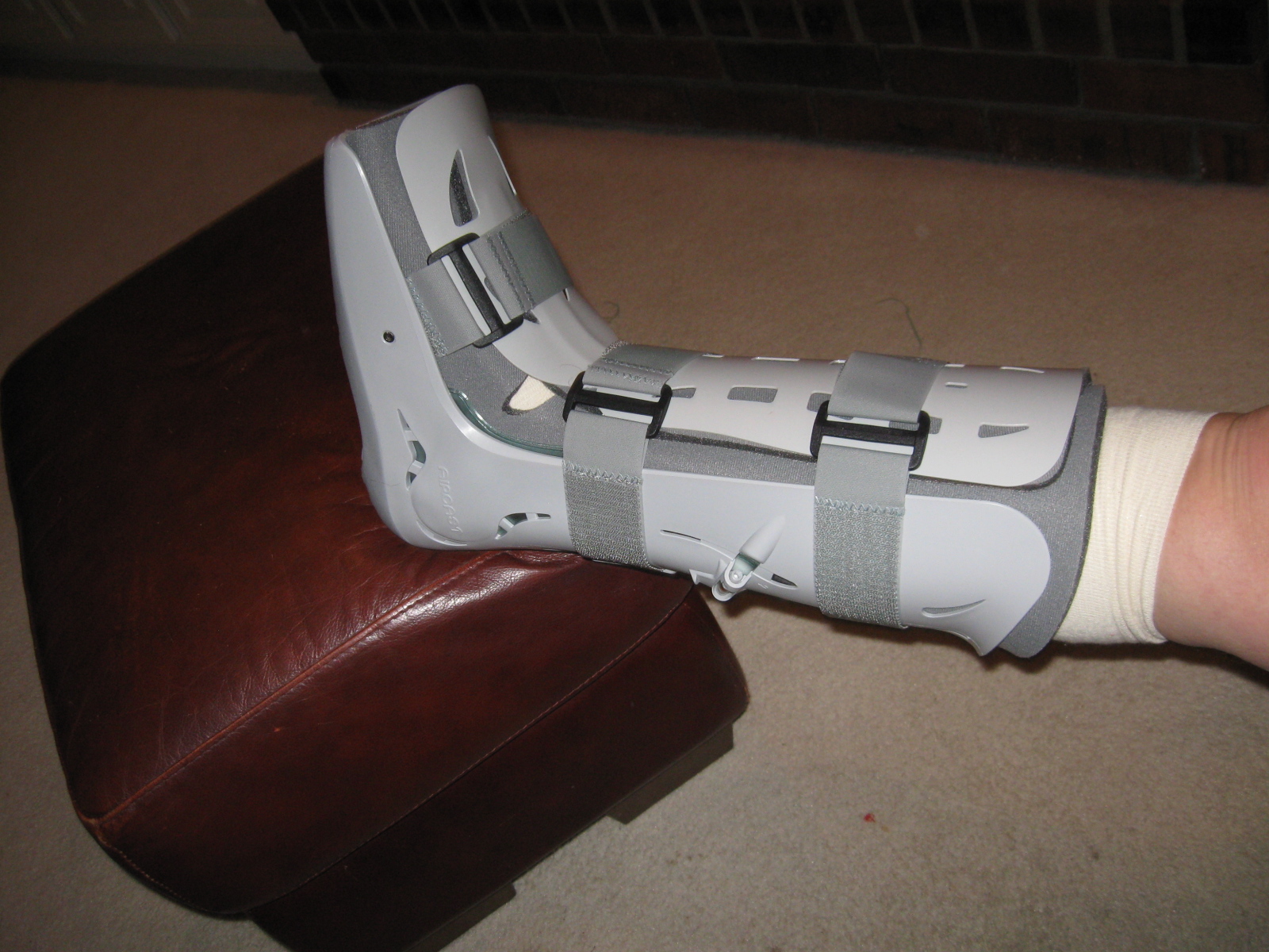 My Ankle Replacement Free at last!