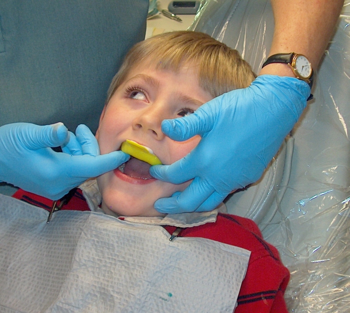 Roselle Dental Flouride