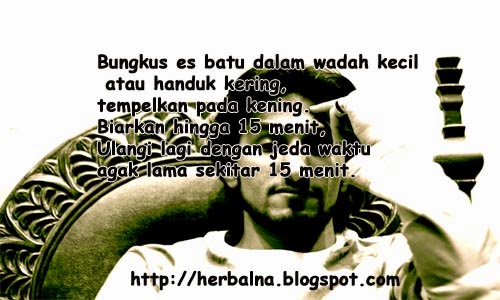 Kumpulan Obat Herbal Sakit Kepala Kumpulan Obat Herbal Sakit Kepala