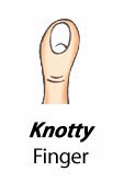 Finger Types - Knotty Finger