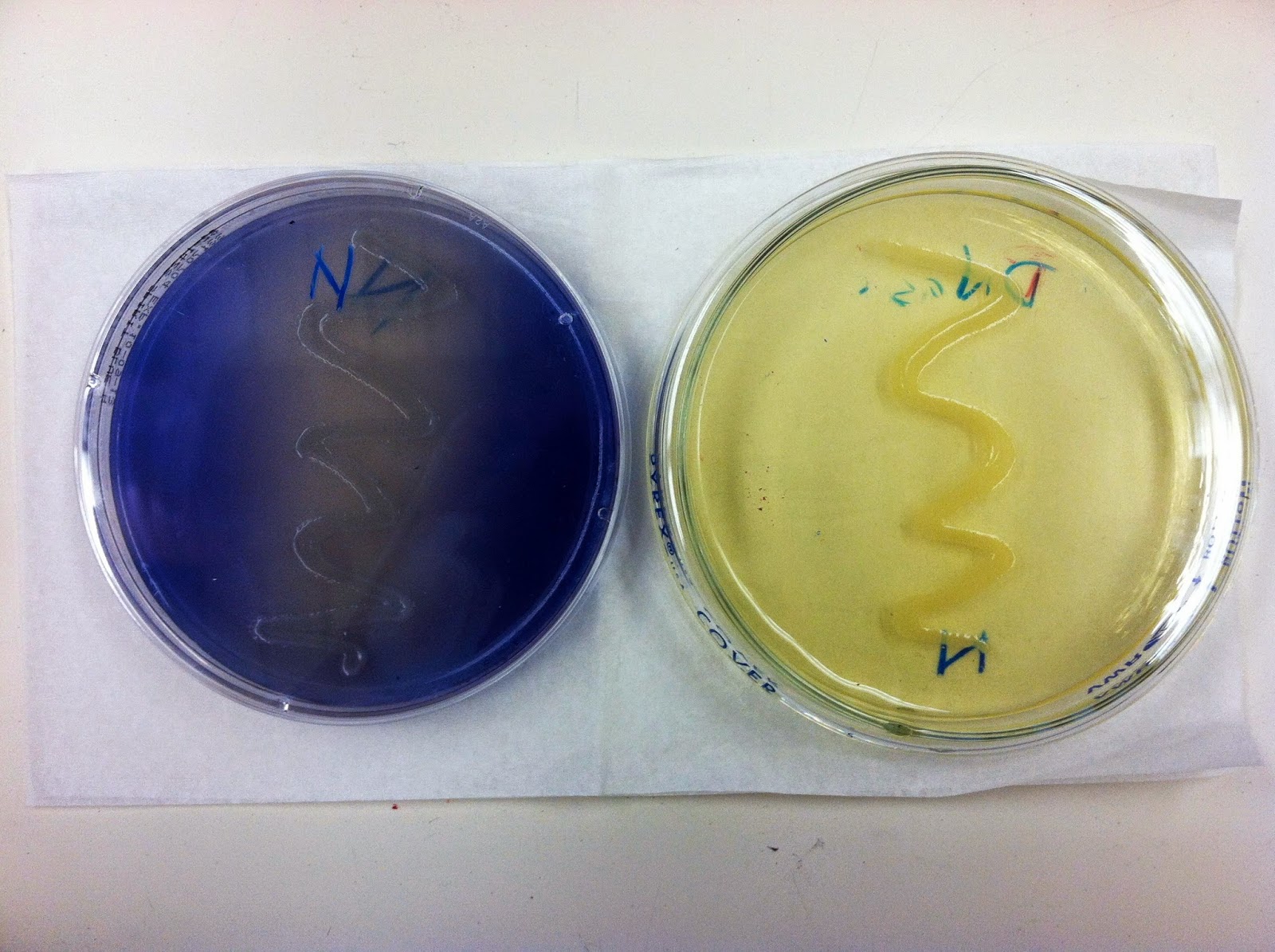 Gelatin hydrolysis test positive bacteria menulily