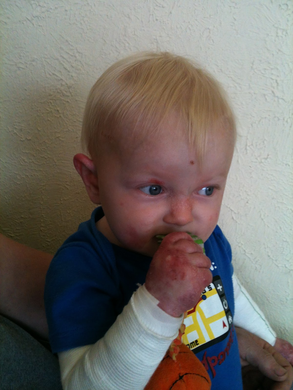 Paper Thin Butterfly Skin The Story Of Our Butterfly Prince