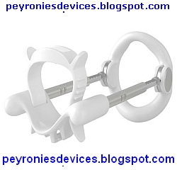 Peyronie's Disease Penis Stretching Devices Cure