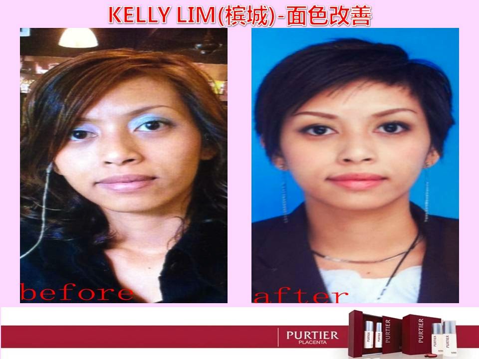 KELLY LIM (PENANG) - FACE LOOKS YOUNGER (REVERSE AGING)