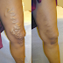 Show Some Legs thumbnail
