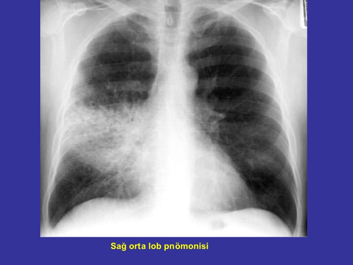 sistem hastaliklari dersi blogger