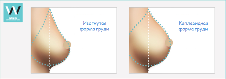 Сколько стоит в уфе увеличить грудь