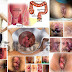 Obat Mujarab Buat Ambeien (Hemoroid) Wanita thumbnail