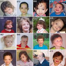 Mrs Stein S 8th Period Sts Biology Wolf Hirschhorn Syndrome 101