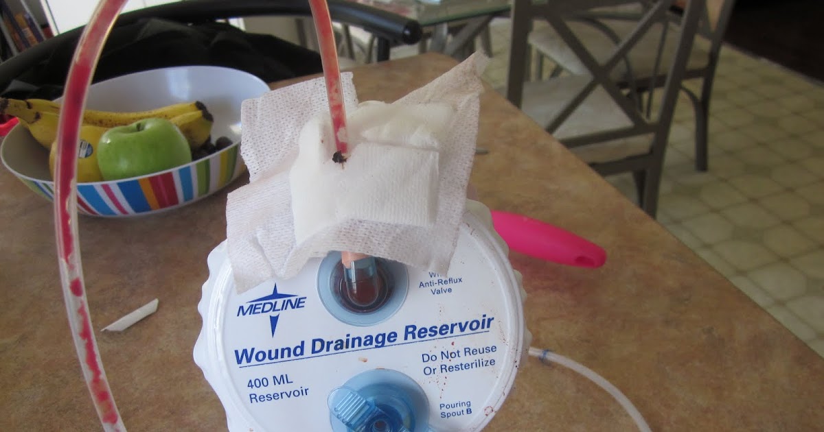 Rantings & Ramblings of a Blonde Bombshell Day 5 Pull a Hemovac