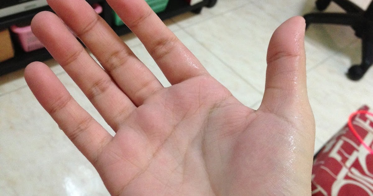 SWEATY PALMS A.K.A PALMAR HYPERHIDROSIS