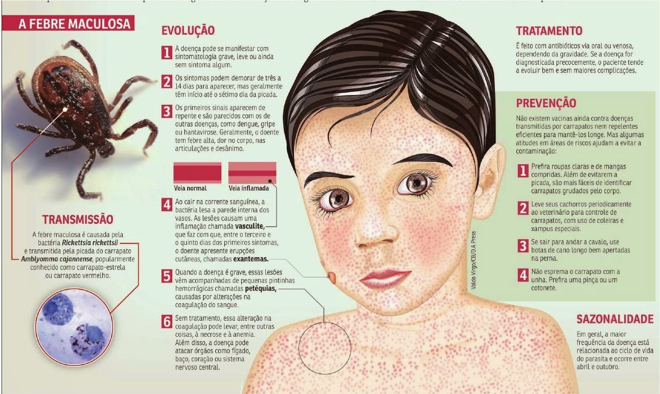 Resultado de imagem para febre maculosa sintomas