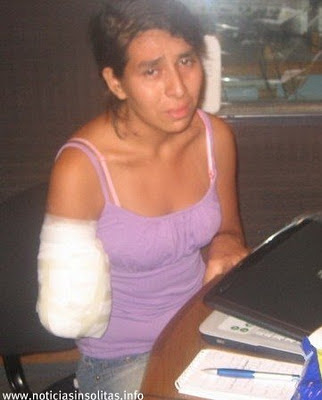 cortan el brazo cuando fue con un dolor estomago