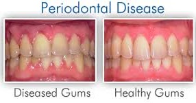 anatomy of mouth and gums