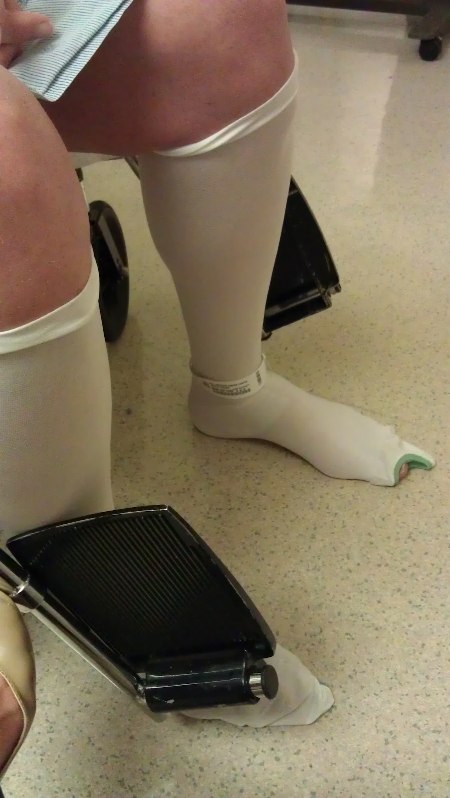 Just Another Bump in the Road Melanoma Surgery Day