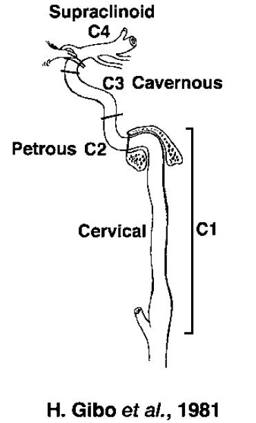 Neuroradiology Cases: Internal carotid artery Anatomy