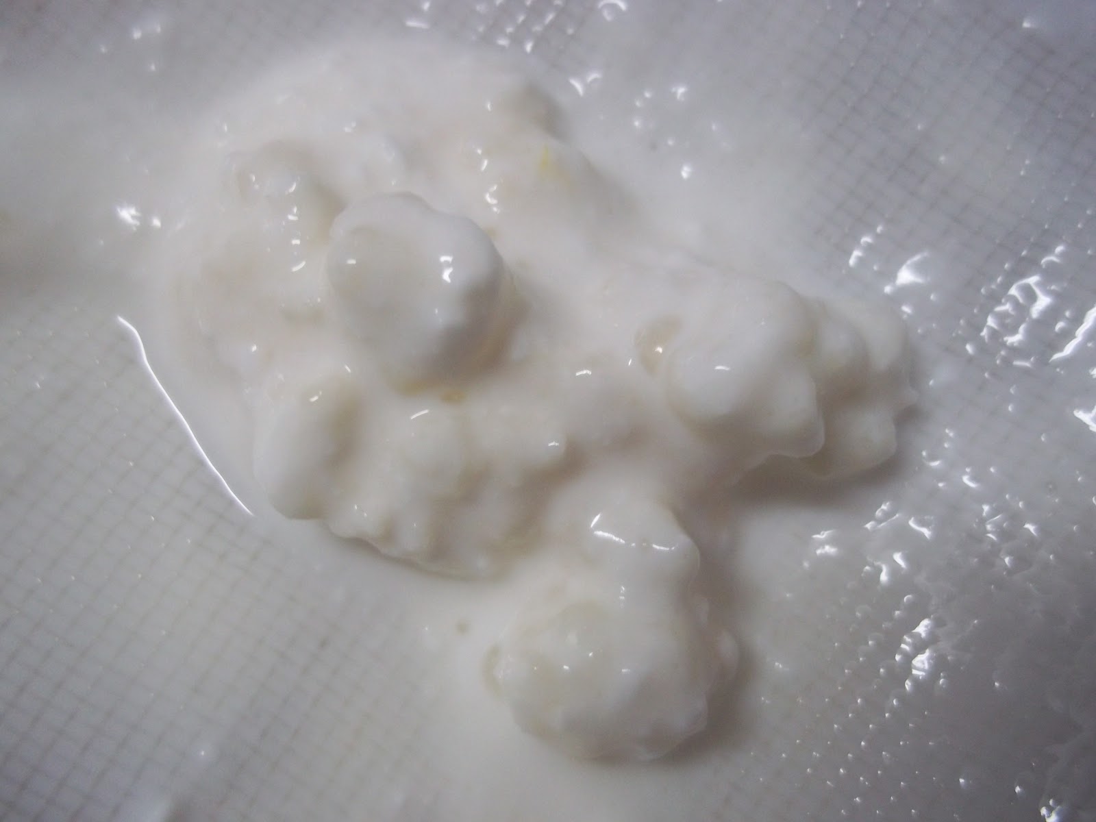 Probiotics for stomach bloating quickly, does probiotic yogurt really