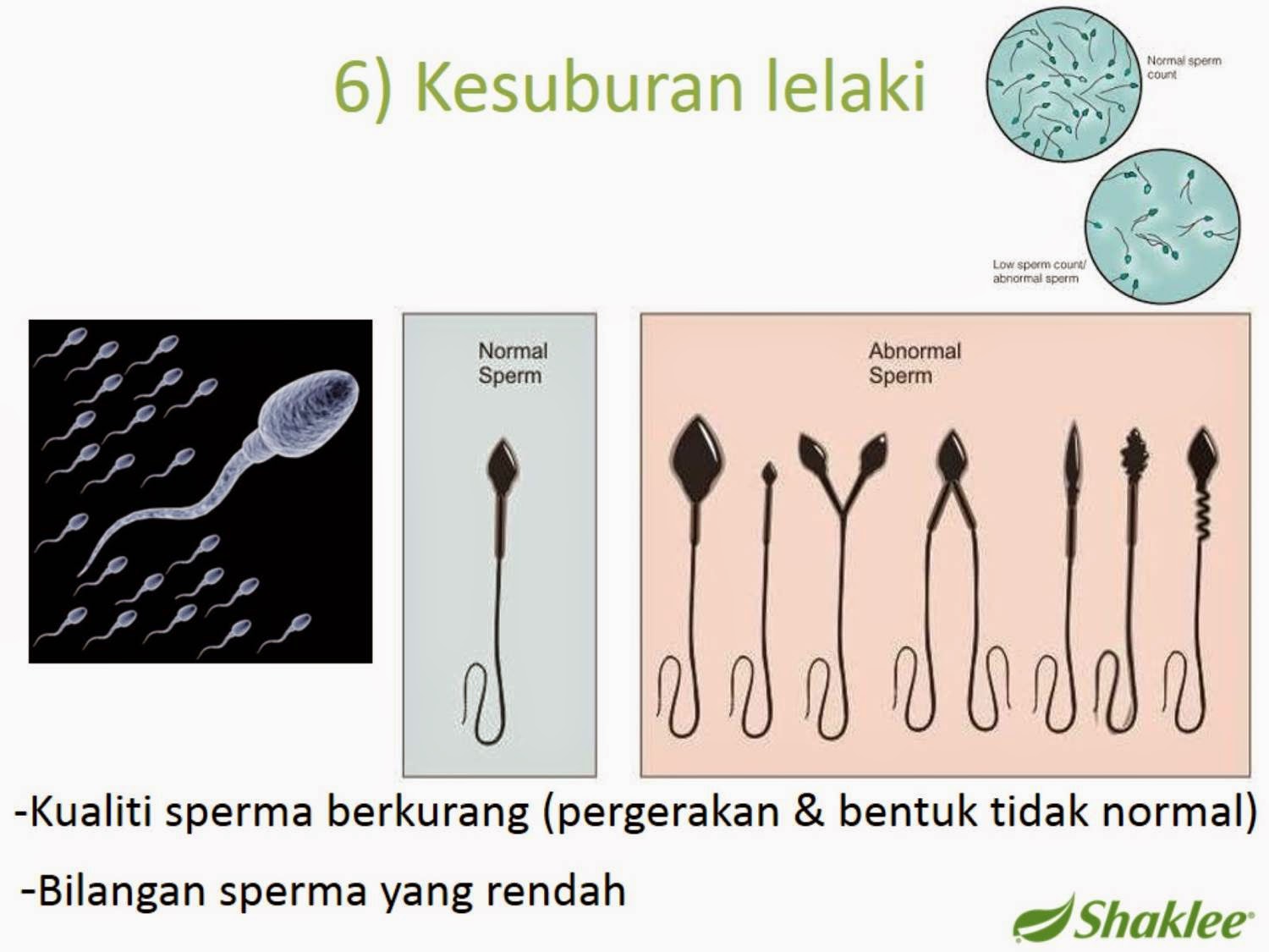 Canabis sperm count