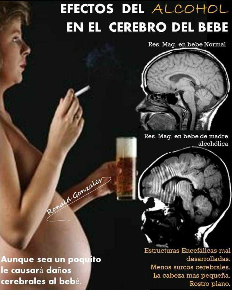 El delirium tremens del vídeo onlayn gratis
