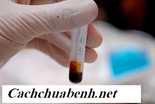 [Image: xet-nghiem-hiv-12.JPG]