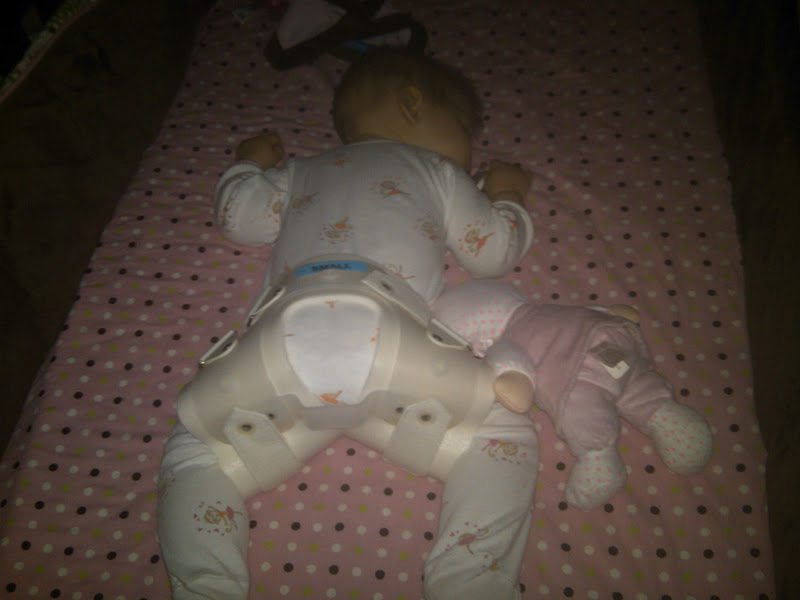 life well loved Sleeping with the abduction brace