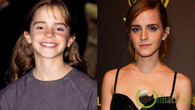 Emma Watson Emma Watson