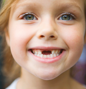 Kids+teeth+image.jpg