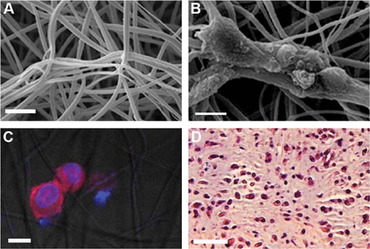 Cartilage Tissue Engineering