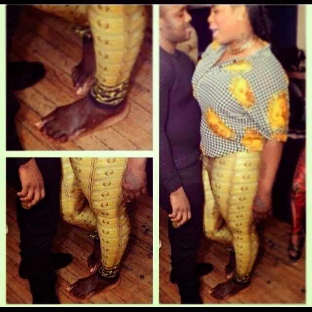 TO HOME OF INFORMATION The very negative Side Effects Of Skin