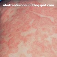 Tradisional | Obat Tradisional | Ramuan Tradisional Alami Indonesia