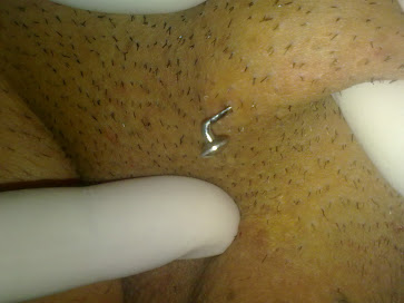 Surface Piercing