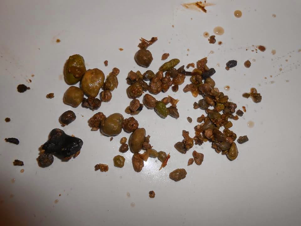 Ryan The Wellness Warrior The Amazing Liver and Gallbladder Flush