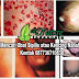 Obat Kencing Nanah Herbal