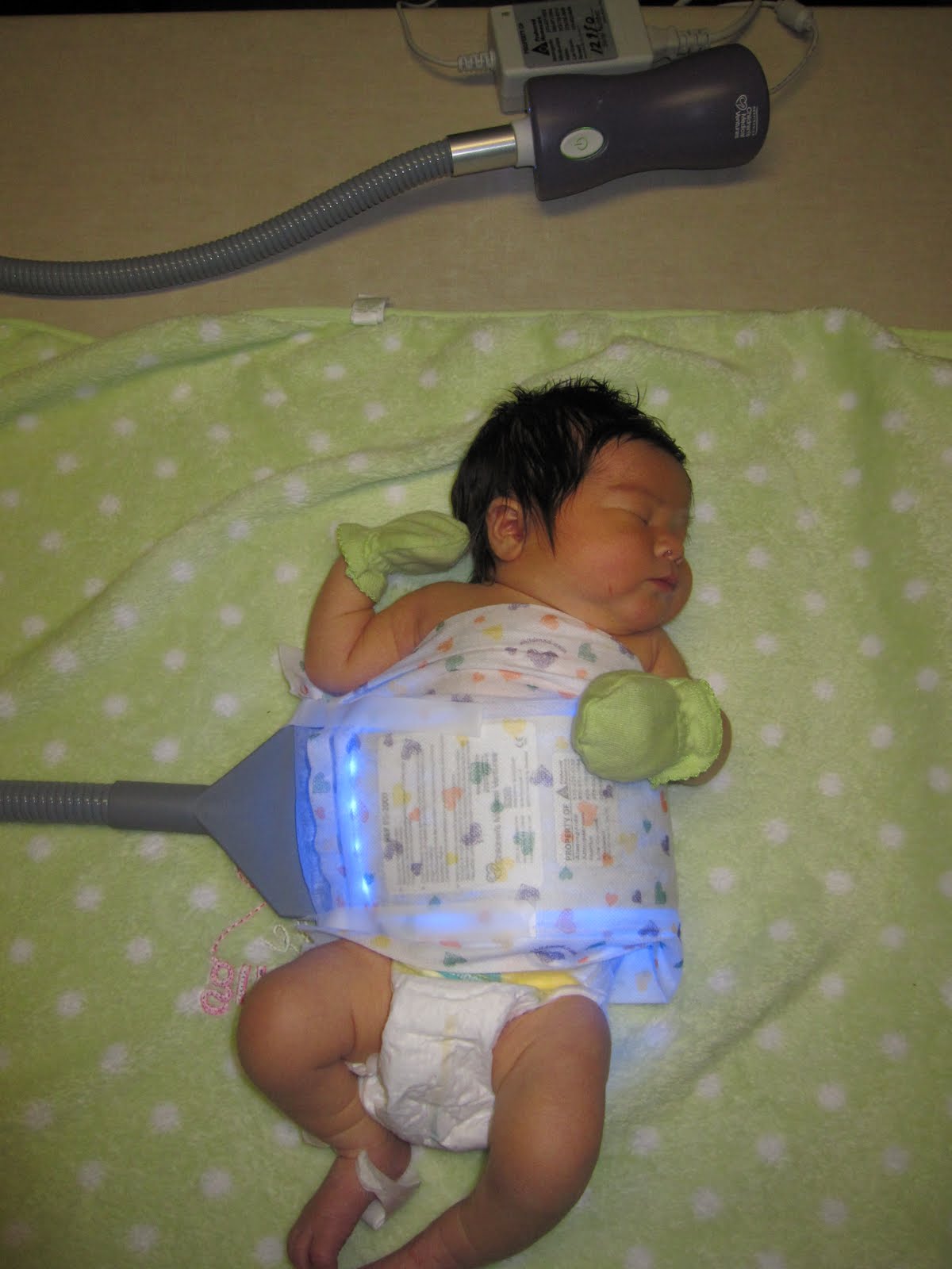 How Does The Biliblanket Work at Nicholas Ashley blog