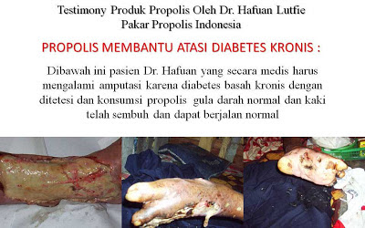 propolis-testimoni-1.jpg